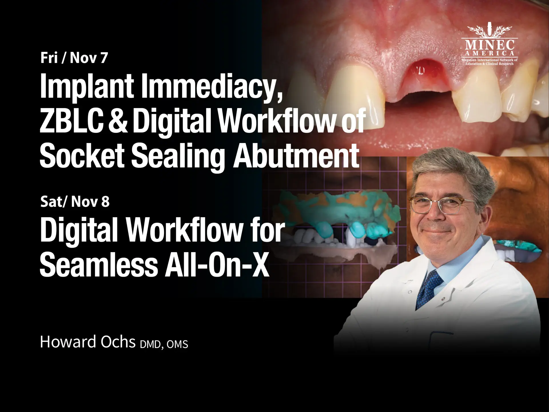 Implant Immediacy, ZBLC & Digital Workflow of Socket Sealing Abutment