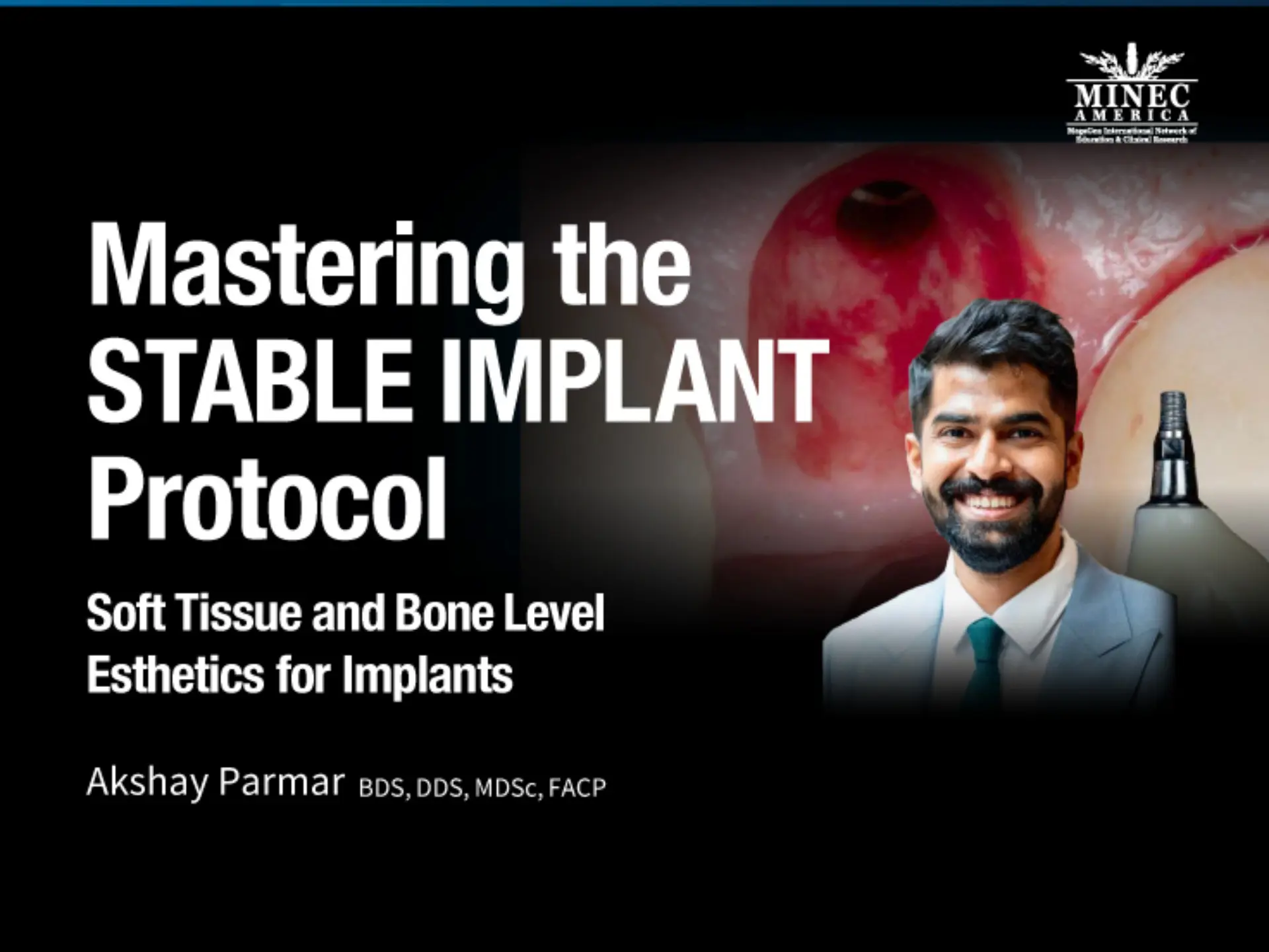 Mastering the STABLE IMPLANT Protocol