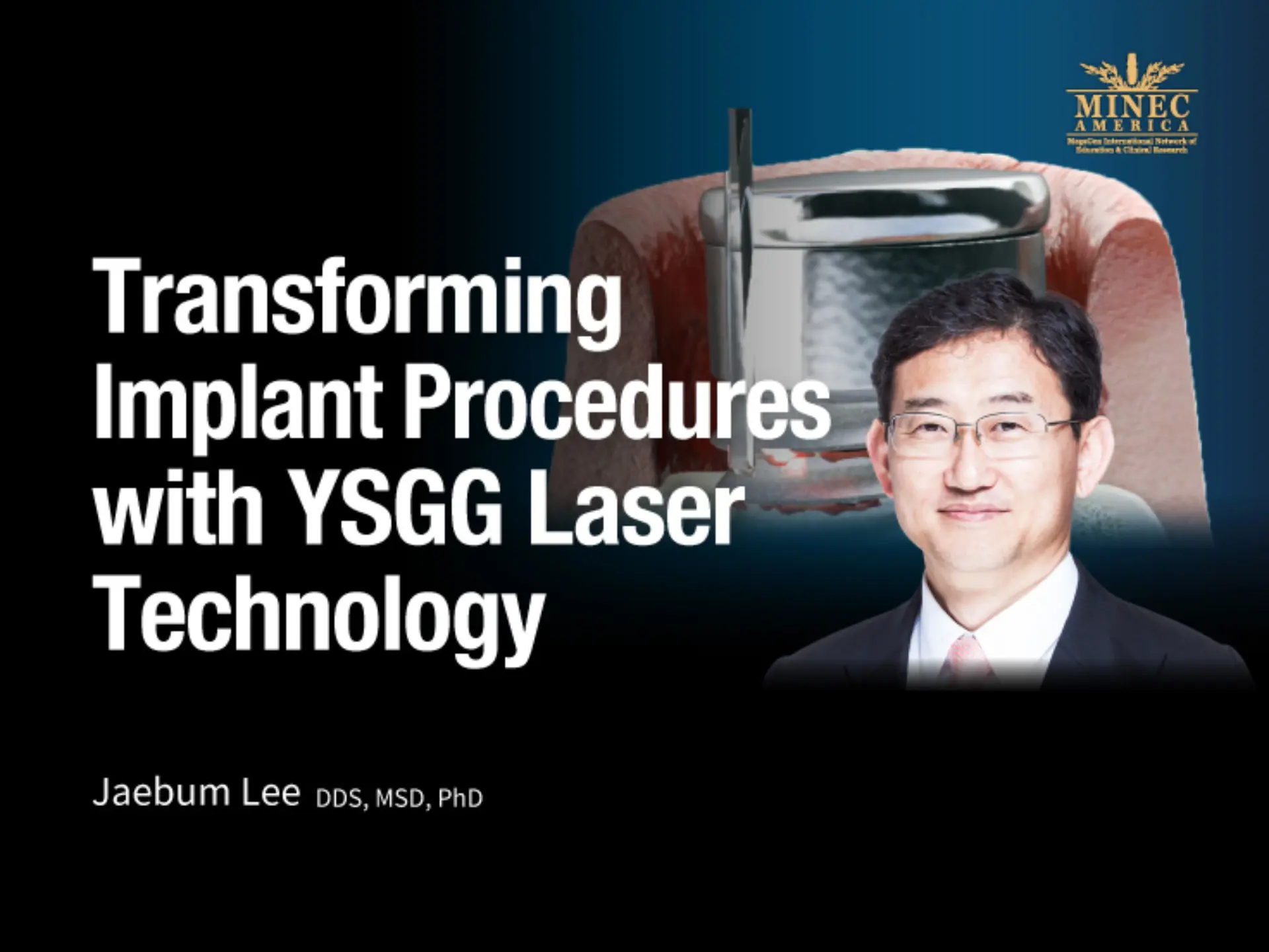 Transforming Implant Procedures with YSGG Laser Technology 