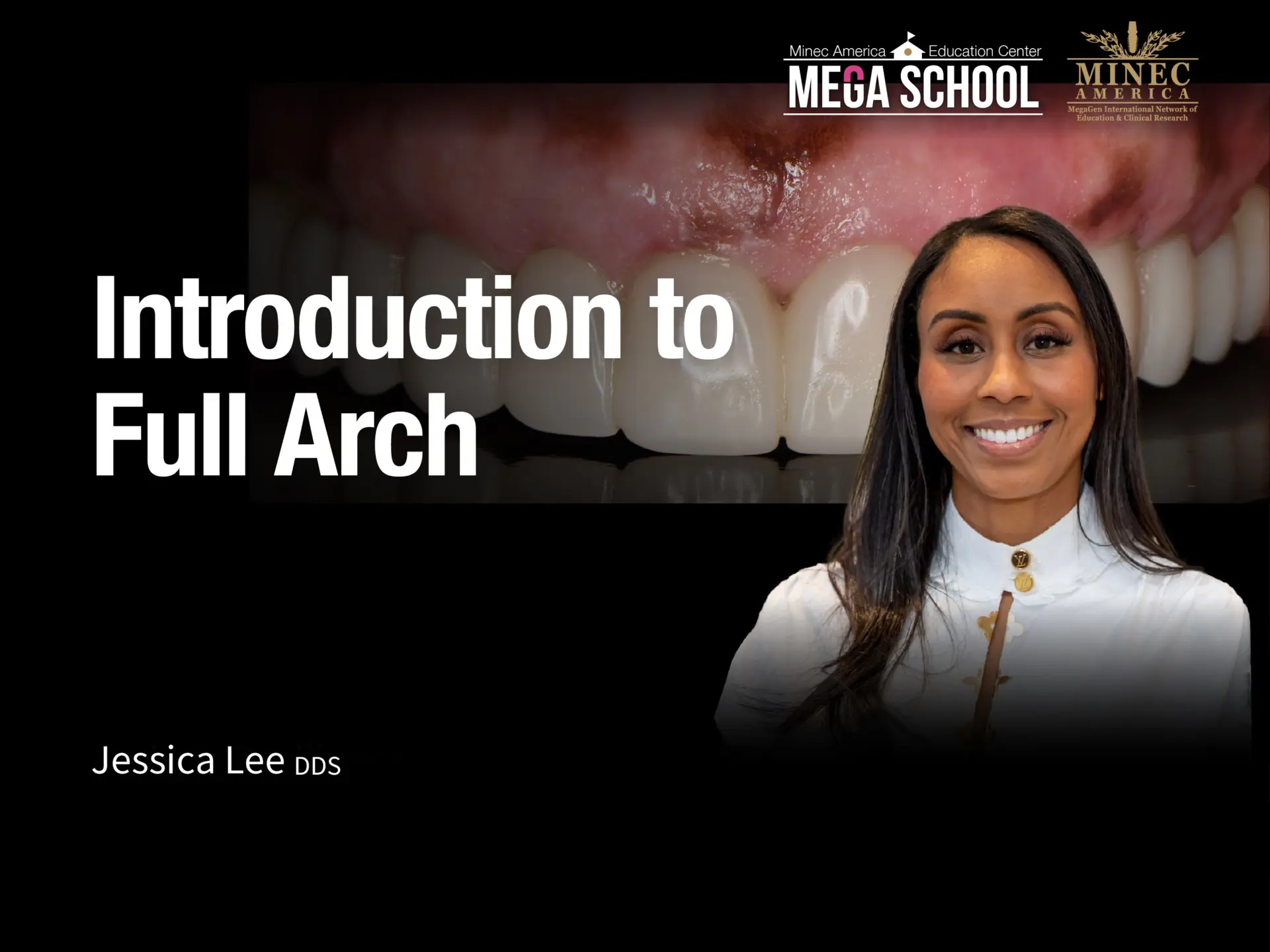 Introduction to Full Arch