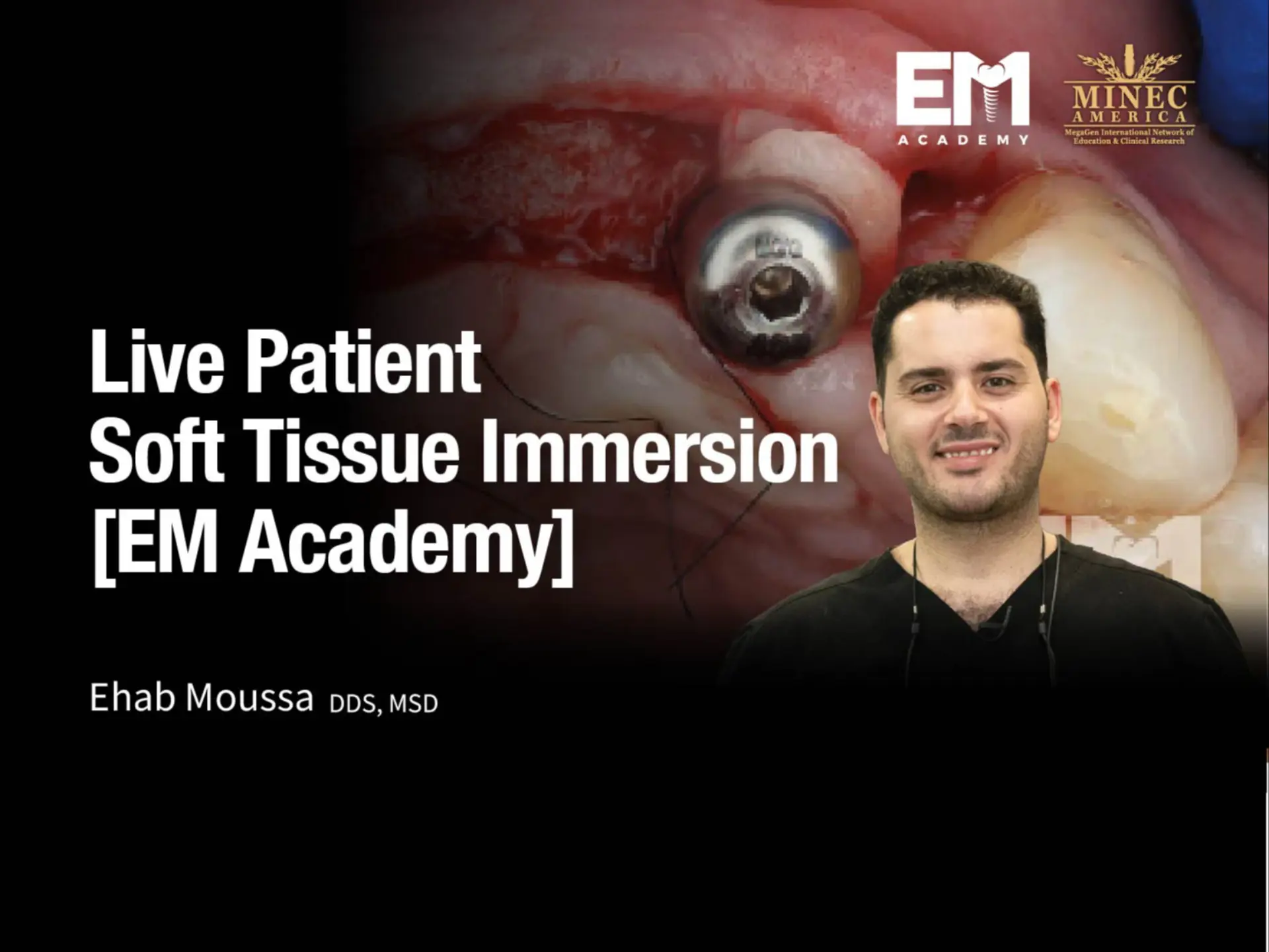 Live Patient Soft Tissue Immersion