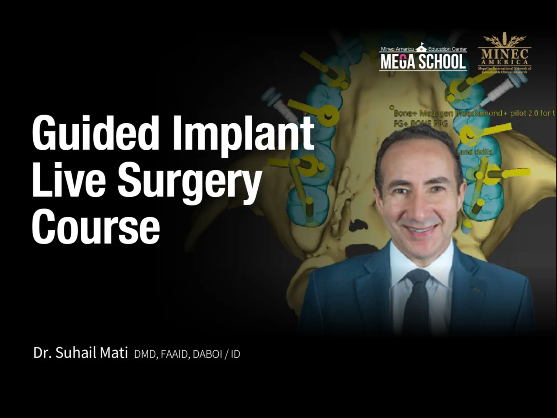 Guided Implant Live Surgery Course
