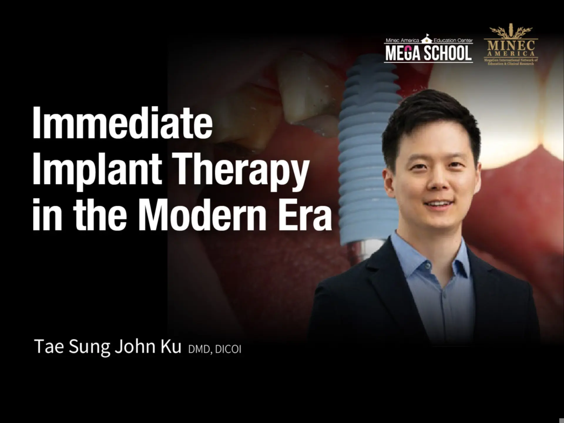 Immediate Implant Therapy in the Modern Era: Strategic Precision,Tissue Preservation, and BD Cuff Revolution