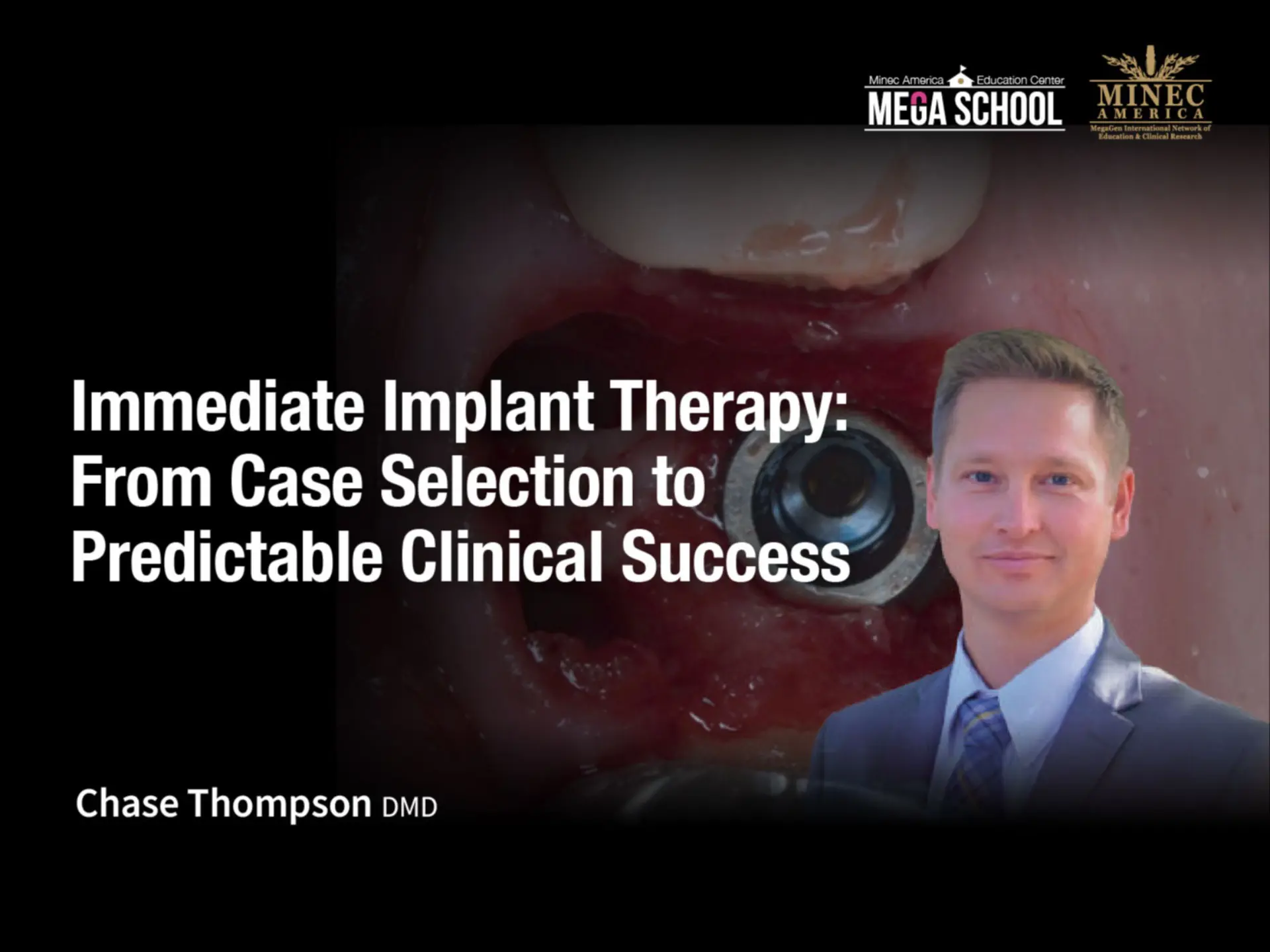 Immediate Implant Therapy: From Case Selection to Predictable Clinical Success - AZ