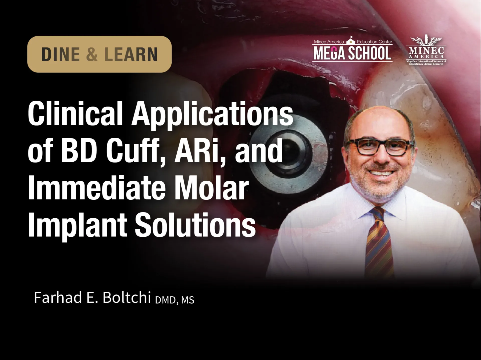 Dine & Learn: Clinical Applications of BD Cuff, ARi, and Immediate Molar Implant Solutions (Dallas, TX)