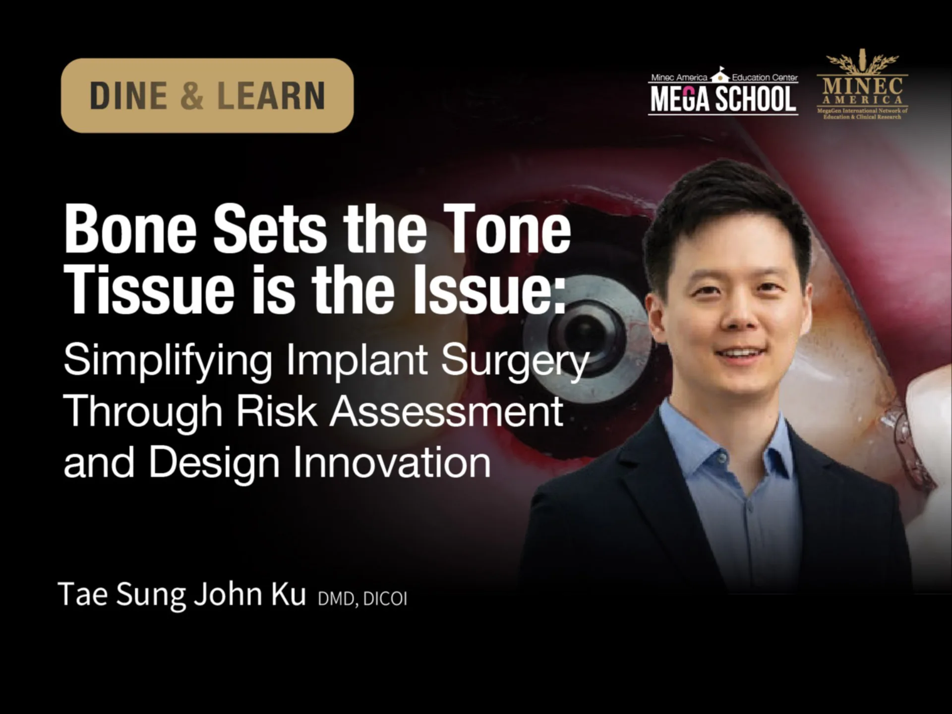 DINE & LEARN: Bone Sets the Tone Tissue is the Issue: Simplifying Implant Surgery Through Risk Assessment and Design Innovation (CO)