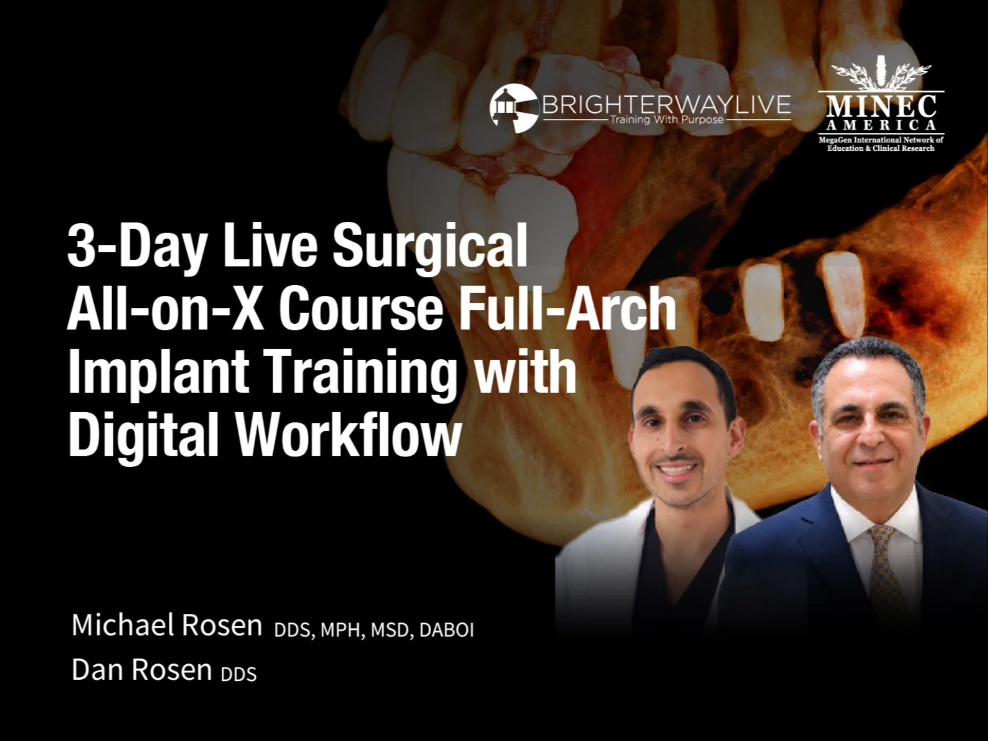3-Day Live Surgical All-on-X Course Full-Arch Implant Training with Digital Workflow